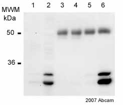 ab30782 immunoprecipitating PHD3 from rat PC12 (whole cell lysate - the cells were either normoxia (21% oxygen) or hypoxia (1% hypoxia). A protein A matrix was used with the antibody at a dilution of 1/1000. A non-Abcam antibody was used in the subsequent western blot. The doublet observed is specific to PHD3 - most probably a modified form or an alternately spliced form. Note: This antibody IP's a hypoxia inducible species of ~27 kDa and ~30 kDa. This is the same molecular weight as the human and mouse isoform, not the SM-20 variant with the N-terminal mitochondrial leader sequence. Lane 1: normoxia - inputLane 2: hypoxia - inputLane 3: normoxia - control antibody IPLane 4: hypoxia - control antibody IPLane 5: normoxia - ab30782 IPLane 6: hypoxia - ab30782 IPSee Abreview