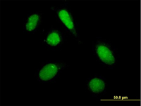 ab67796, at 10µg/ml, staining PHF20L1 in Hela cell