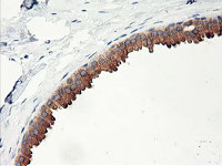 ab119249, at 1/150, staining PHF21B in paraffin-embedded Human Breast tissue by Immunohistochemistry.