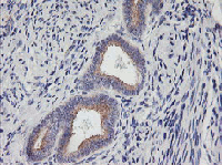 ab119249, at 1/150, staining PHF21B in paraffin-embedded Human Endometrium tissue by Immunohistochemistry.