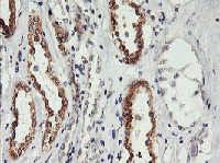 ab119249, at 1/150, staining PHF21B in paraffin-embedded Human Kidney tissue by Immunohistochemistry.
