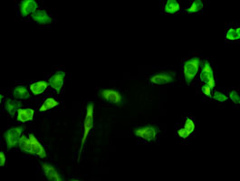 PHGDH antibody (ab57030) used in immunofluorescence at 1-5ug/ml on HeLa cells.