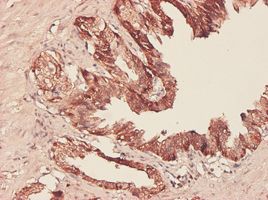 PHGDH antibody (ab57030) used in immunohistochemistry at 5ug/ml on formalin fixed and paraffin embedded human lymph node.