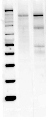 Western blot analysis of nNOS was performed by loading 40 ?g of Mouse (Lane 1) and Rat Brain (Lane 2) tissue lysate onto a 4-12% Bis-Tris polyacrylamide gel. Proteins were transferred to a Nitrocellulose membrane. Membranes were probed with a rabbit polyclonal antibody (ab3511) recognizing nNOS at a dilution of 1:1000.