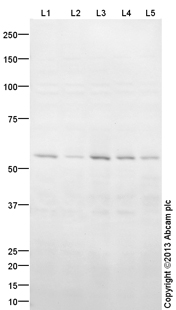 All lanes : Anti-PHGDH antibody (ab133133) at 1 µg/mlLane 1 : HeLa (Human epithelial carcinoma cell line) Whole Cell LysateLane 2 : Jurkat (Human T cell lymphoblast-like cell line) Whole Cell LysateLane 3 : A431 (Human epithelial carcinoma cell line) Whole Cell LysateLane 4 : Raji (Human Burkitt's lymphoma cell line) Whole Cell LysateLane 5 : MCF7 (Human breast adenocarcinoma cell line) Whole Cell Lysate Lysates/proteins at 10 µg per lane.SecondaryGoat Anti-Rabbit IgG H&L (HRP) (ab97051) at 1/10000 dilutiondeveloped using the ECL techniquePerformed under reducing conditions.