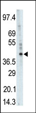 Anti-PHKG1 antibody (ab37982) at 1/100 dilution + A375 cell lysateSecondaryHRP-anti-rabbit was used for signal visualization with chemiluminescence.