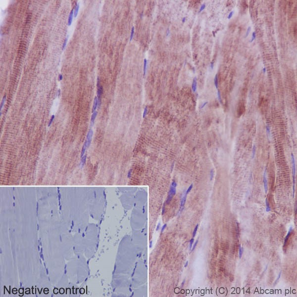 Immunohistochemical analysis of paraffin-embedded Human skeletal muscle tissue labeling PHKG1 with ab194112 at 1/250 dilution, followed by prediluted HRP Polymer for Rabbit/Mouse IgG. Counter stained with Hematoxylin.