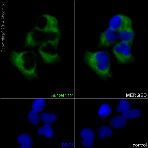 Immunofluorescent analysis of 4% paraformaldehyde-fixed, 0.1% tritonX-100 permeabilized A673 cells labeling PHKG1 with ab194112 at 1/100 dilution, followed by Goat anti-rabbit IgG (Alexa Fluor®488) secondary antibody (ab150077) at 1/400 dilution. Nuclear counter stain is DAPI (blue).