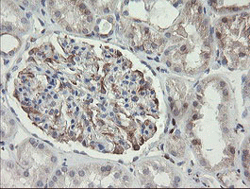 Immunohistochemical analysis of paraffin-embedded Human kidney tissue labelling PHKG2 with ab131662 at 1/150 dilution.