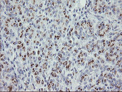 Immunohistochemical analysis of paraffin-embedded Human pancreas tissue labelling PHKG2 with ab131662 at 1/150 dilution.