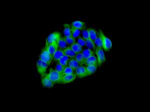 Immunofluorescent staining of HepG2 cells labeling PHKG2 with ab167424 at 1/100 dilution.