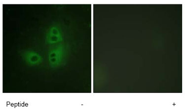 ab63602, at a 1/500 dilution, staining Human nNos (neuronal) in HeLa cells, by Immunofluorescence, with (+) or without (-) immunising peptide.