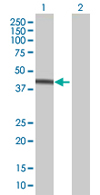All lanes : Anti-PHLDA1 antibody (ab67849) at 1/500 dilutionLane 1 : PHLDA1 transfected 293T cell lysateLane 2 : Non-transfected 293T cell lysateLysates/proteins at 25 µg per lane.SecondaryGoat Anti-Mouse IgG (H&L)-HRP Conjugate at 1/2500 dilution