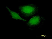 ab67849 at 10µg/ml staining PHLDA1 in Hela cells.