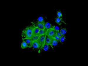 Immunocytochemical analysis of PHLDA1 in BxPC3 cells labelled with ab133654 at a 1/100 dilution.