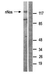All lanes : Anti-nNOS (neuronal) antibody (ab63602) at 1/500 dilutionLane 1 : RAW264.7 cell extract treated with INF (2500u/ml, 10mins)Lane 2 : RAW264.7 cell extract treated with INF (2500u/ml, 10mins) with the immunising peptide at 10 µgLysates/proteins at 30 µg per lane.