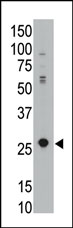 Anti-PHO1 antibody (ab38641) + jurkat cell lysate