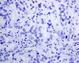 Immunohistochemical analysis of paraffin embedded normal Human tonsil tissue using ab150369 showing -ve staining.