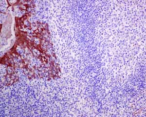 Immunohistochemical analysis of paraffin embedded normal Human tonsil tissue using ab150369 showing +ve staining.