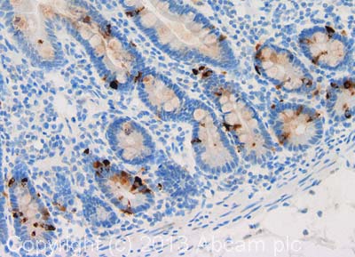 IHC image of Phospholamban staining in human duodenum formalin fixed paraffin embedded tissue section, performed on a Leica BondTM system using the standard protocol F. The section was pre-treated using heat mediated antigen retrieval with sodium citrate buffer (pH6, epitope retrieval solution 1) for 20 mins. The section was then incubated with ab85146, 1µg/ml, for 15 mins at room temperature and detected using an HRP conjugated compact polymer system. DAB was used as the chromogen. The section was then counterstained with haematoxylin and mounted with DPX. For other IHC staining systems (automated and non-automated) customers should optimize variable parameters such as antigen retrieval conditions, primary antibody concentration and antibody incubation times.