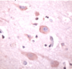 Ab41863 staining human Phospholipase C beta 1 in human brain by immunohistochemistry using formalin fixed paraffin embedded tissue.