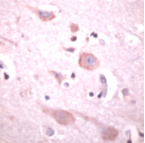 Ab41864 staining human Phospholipase C beta 1 in human brain by immunohistochemistry using formalin fixed paraffin embedded tissue.