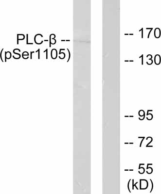 All lanes : Anti-Phospholipase C beta 3 (phospho S1105) antibody (ab52206) at 1/500 dilutionLane 1 : extracts from A431 cells with no immunising peptideLane 2 : extracts from A431 cells with immunising peptide