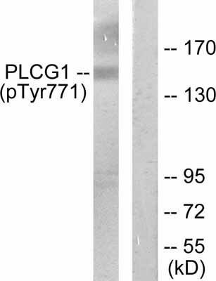 All lanes : Anti-Phospholipase C gamma 1 (phospho Y771) antibody (ab52207) at 1/500 dilutionLane 1 : Extracts from COS7 cells treated with EGF (200ng/ml, 30min) with no immunising peptideLane 2 : Extracts from COS7 cells treated with EGF (200ng/ml, 30min) with immunising peptide