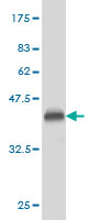 Western blot against tagged recombinant protein immunogen using ab58118 Phospholipase D2 antibody at 1ug/ml.
