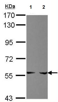 All lanes : Anti-Phosphoribosyl pyrophosphate amidotransferase antibody (ab125864) at 1/1000 dilutionLane 1 : HepG2 whole cell lysateLane 2 : HCT116 whole cell lysateLysates/proteins at 30 µg per lane.