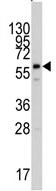 Anti-Phosphoribosyl pyrophosphate amidotransferase antibody (ab71340) at 1/60 dilution + HepG2 cell line lysate at 35 µg