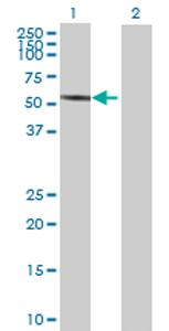 All lanes : Anti-Phosphoribosyl pyrophosphate amidotransferase antibody (ab72941) at 1/500 dilutionLane 1 : Phosphoribosyl pyrophosphate amidotransferase Transfected 293T cell lysateLane 2 : Non-transfected 293T cell lysateLysates/proteins at 25 µg per lane.SecondaryGoat anti-mouse IgG (H&L)-HRP conjugate at 1/2500 dilution