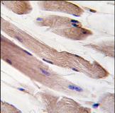 ab71522, at a 1/10 dilution, staining Pl 3 Kinase p85 alpha in formalin fixed, paraffin embedded human skeletal muscle tissue by Immunohistochemistry. ab71522 was peroxidase conjugated to the secondary antibody, followed by DAB staining.