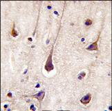1/10 ab71052, staining PI 3 Kinase p85 beta in formalin fixed, paraffin embedded human brain tissue (peroxidase conjugated secondary antibody, DAB staining).