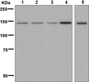 All lanes : Anti-PI 3 Kinase regulatory subunit 4 antibody [EPR5302(2)] (ab128903) at 1/1000 dilutionLane 1 : Jurkat cell lysateLane 2 : 293T cell lysateLane 3 : HeLa cell lysateLane 4 : Raji cell lysateLane 5 : MOLT4 cell lysateLysates/proteins at 10 µg per lane.SecondaryGoat anti-Rabbit HRP at 1/2000 dilutiondeveloped using the ECL technique