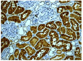 ab124817 at 1/100 dilution, staining PI 3 Kinase regulatory subunit 4 in Formalin fixed Paraffin-embedded Human kidney tissue by Immunohistochemistry.