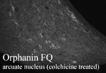 ab10277, at a dilution of 1/500, staining Nociceptin (Orphanin FQ, OFQ) in arcuate nucleus region of rat hypothalamus section by Immunohistochemistry (PFA perfusion fixed frozen sections).