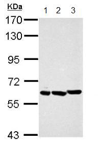 All lanes : Anti-PIAS2 antibody (ab155556) at 1/10000 dilutionLane 1 : NIH-3T3 whole cell lysateLane 2 : JC whole cell lysateLane 3 : BCL-1 whole cell lysateLysates/proteins at 30 µg per lane.