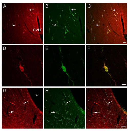 Confocal images showing Nociceptin (OFQ) (red), GnRH (green) and their colocalization (yellow) in the sheep preoptic area and hypothalamus. A-C: Low power view of the preoptic area at the level of the organum vasculosum of the lamina terminalis (OVLT) showing OFQ and GnRH cells, and their colocalization (e.g., white arrows). Bar = 100µm. D-F: High power images of a double-labeled OFQ/GnRH cell; note that the immunofluorescence for OFQ has a punctateappearance in the cytoplasm as opposed to the more diffuse appearance of the GnRH signal. Bar 26 = 20µm. G-I: Single-labeled OFQ cells (e.g., red arrow) in the arcuate nucleus. Note that many GnRH fibers coursing through this region are also OFQ-positive (e.g., white arrows). 3v = third ventricle. Bar = 100µm.
