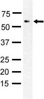 Western blot analysis of anti-PIASx1/2 Pab (ab4902) in Y79 cell lysate. PIASx1/2 (arrow) was detected using purified Pab. Secondary HRP-anti-rabbit was used for signal visualization with chemiluminescence.