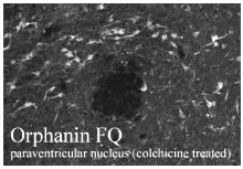 ab10276 at 1/500 dilution staining  Nociceptin in paraventricular nucleus by Immunohistochemistry.