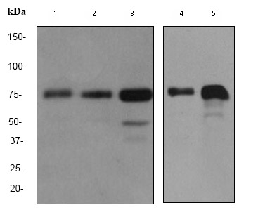All lanes : Anti-PIAS3 + PIAS1 + PIAS2 antibody [EPR2581Y] (ab77231) at 1/50000 dilutionLane 1 : Daudi cell lysateLane 2 : 293 cell lysateLane 3 : Jurkat cell lysateLane 4 : SW40 cell lysateLane 5 : HepG2 cell lysateLysates/proteins at 10 µg per lane.SecondaryHRP labelled goat anti-rabbit at 1/2000 dilution