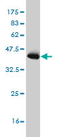 Western blot against tagged recombinant protein immunogen using ab56698 PIAS3 antibody at 1ug/ml.
