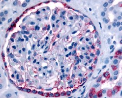 Ab61147 (14ug/ml) staining human PIB5PA in human glomerulus and renal tubular epithelium in cortex tissue by immunohistochemistry using formalin fixed, paraffin embedded tissue.