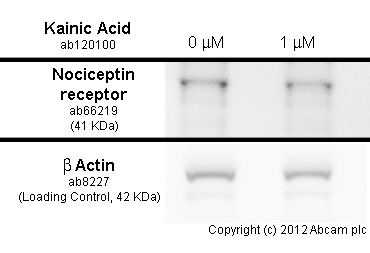 developed using the ECL techniquePerformed under reducing conditions.