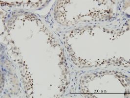 NFYC antibody (ab55799) used in immunohistochemistry at 3ug/ml on formalin fixed and paraffin embedded human testis.