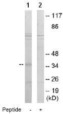 All lanes : Anti-PIG3 antibody (ab64980) at 1/500 dilutionLane 1 : Extracts from 293 cellsLane 2 : Extracts from 293 cells with immunising peptide