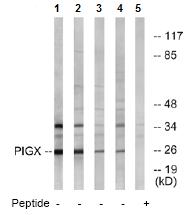 All lanes : Anti-PIGX antibody (ab74670) at 1/500 dilutionLane 1 : extracts from COLO 205 cellsLane 2 : extracts from 293 cellsLane 3 : extracts from HUVEC cellsLane 4 : extracts from Jurkat cellsLane 5 : extracts from 293 cells with immunizing peptide at 10 µgLysates/proteins at 30 µg per lane.