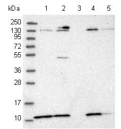 All lanes : Anti-PIGY antibody (ab122338) at 1/250 dilutionLane 1 : RT-4 cell lysateLane 2 : U-251 MG cell lysateLane 3 : Human plasmaLane 4 : Human liver lysateLane 5 : Human tonsil lysatedeveloped using the ECL technique