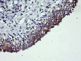 Immunohistochemical analysis of paraffin-embedded Human bladder tissue, labelling PIK3C2B with ab140525 at 1/150 dilution.